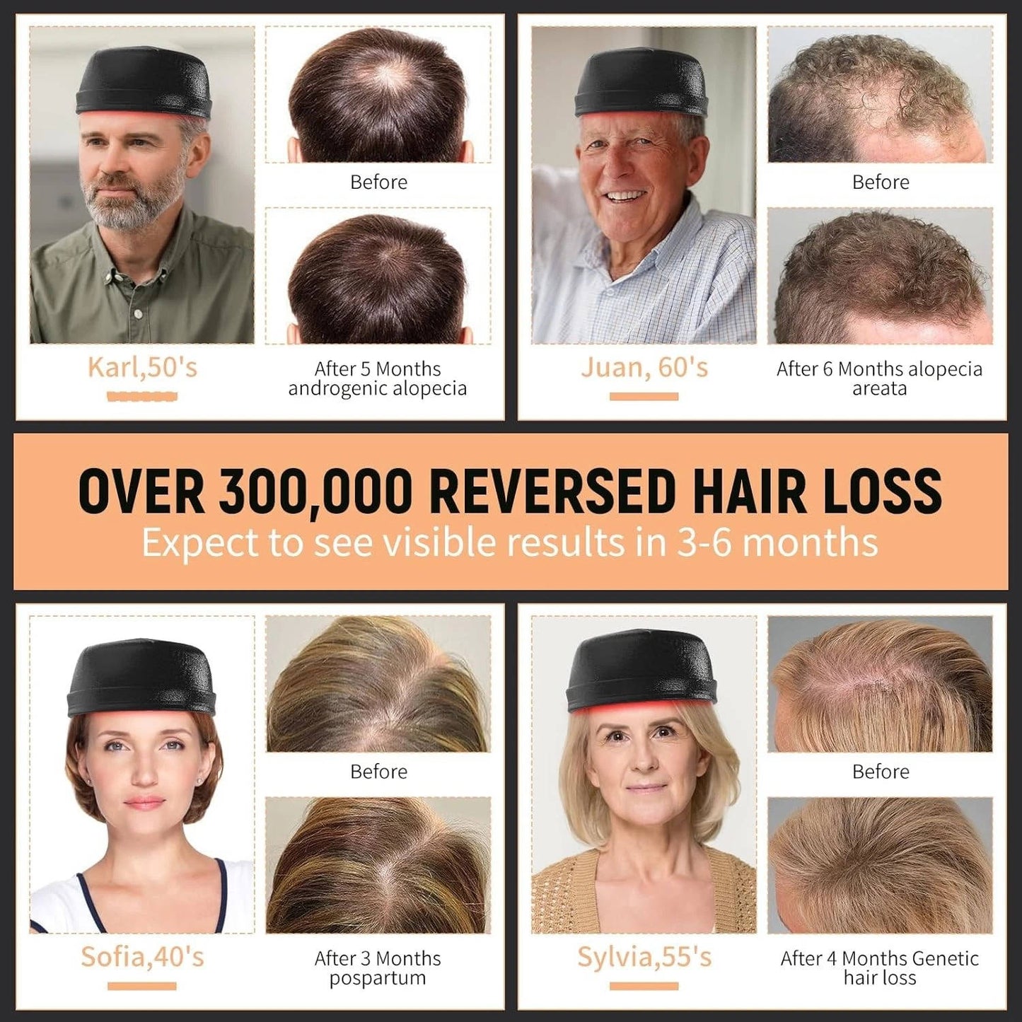 Laser Hair Growth Cap - Red Light Hair Loss Therapy 660Nm & 850Nm - Fda Cleared