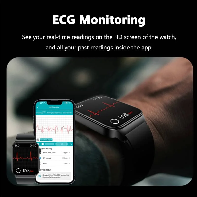 Reloj inteligente ECG – Monitor de presión arterial, glucosa, temperatura corporal y frecuencia cardíaca