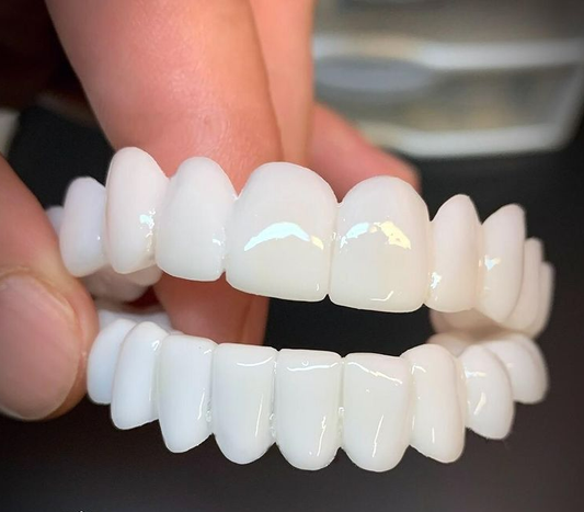 Ventayo – Snap On Teeth Veneers with Custom Fit for Natural Smile