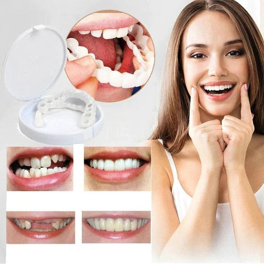 Ventayo – Snap-On Veneers Set for Upper & Lower Teeth with Custom Fit | Removable Solution for a Natural-Looking Smile