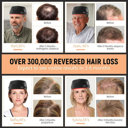 Laser Hair Growth Cap - Red Light Hair Loss Therapy 660Nm & 850Nm - Fda Cleared